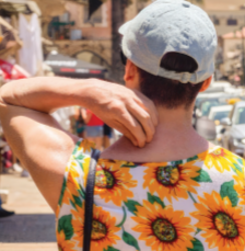 Paulo's moderate-to-severe atopic dermatitis on back at twenty one years old