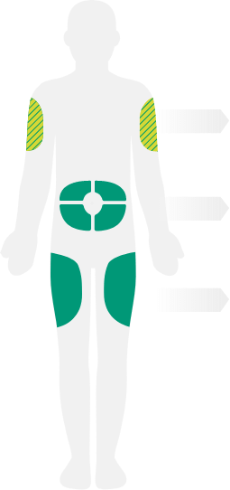 Human body diagram of ideal Dupixent® (dupilumab) administration sites including outer upper arms, abdomen, and thighs