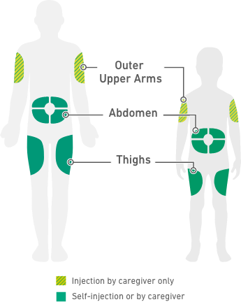 Human body diagram of ideal Dupixent® (dupilumab) administration sites including outer upper arms, abdomen, and thighs