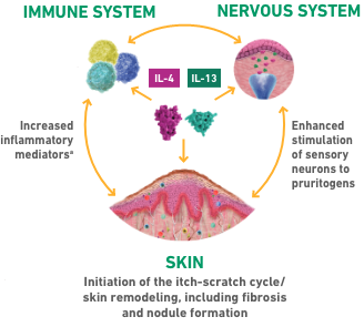 Diagram of the itch-scratch cycle perpetuated by type 2 inflammation that plays a key role in PN