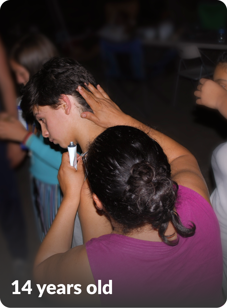 Paulo's moderate-to-severe atopic dermatitis on face at fourteen years old