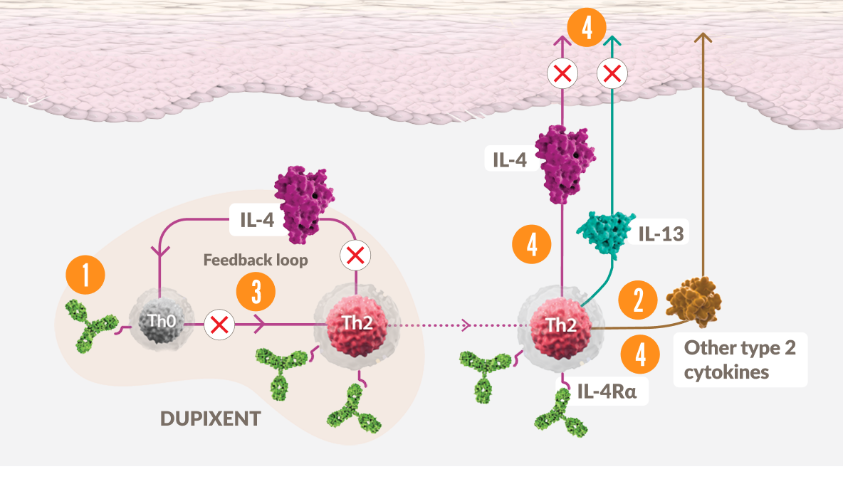 Diagram of Dupixent® (dupilumab) inhibiting IL-4 and IL-13 signaling