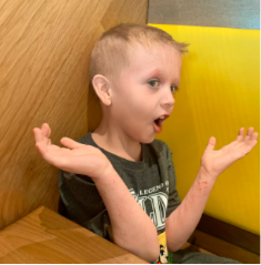 Beckett's moderate-to-severe atopic dermatitis at seven years old