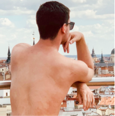 Paulo's moderate-to-severe atopic dermatitis on back at twenty one years old
