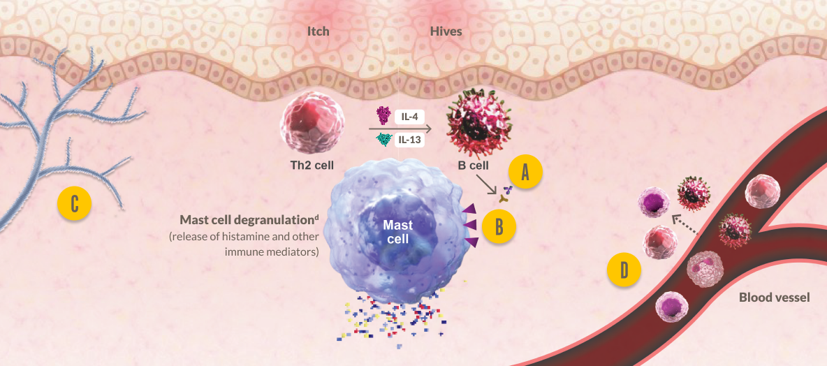 Diagram demonstrating how type 2 inflammation may contribute to disease chronicity in CSU