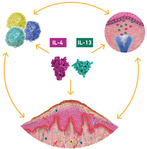 Diagram of the itch-scratch cycle perpetuated by type 2 inflammation that plays a key role in PN